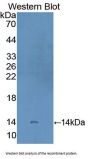 Carcinoembryonic Antigen Related Cell Adhesion Molecule 1 (CEACAM1) Antibody
