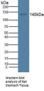 Cross Linked C-Telopeptide of Type I Collagen (CTXI) Antibody