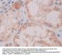 Cross Linked C-Telopeptide of Type I Collagen (CTXI) Antibody