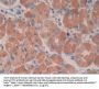 Cross Linked C-Telopeptide of Type I Collagen (CTXI) Antibody