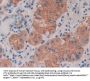 Cross Linked C-Telopeptide of Type I Collagen (CTXI) Antibody