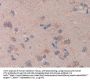 Cross Linked C-Telopeptide of Type I Collagen (CTXI) Antibody