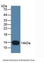 Cystatin B (CSTB) Antibody