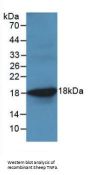 Tumor Necrosis Factor (TNF) Antibody