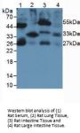 Interleukin 33 (IL33) Antibody