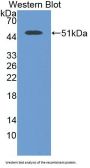 Gamma-Enolase (ENO2) Antibody