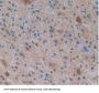 Gamma-Enolase (ENO2) Antibody