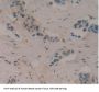 Gamma-Enolase (ENO2) Antibody