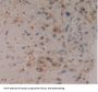 Gamma-Enolase (ENO2) Antibody