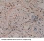Gamma-Enolase (ENO2) Antibody