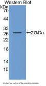 Glutathione S Transferase Alpha 3 (GSTa3) Antibody