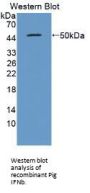 Interferon Beta (IFNb) Antibody