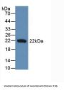 Interferon Beta (IFNb) Antibody