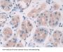 Interleukin 28A (IL28A) Antibody