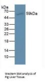 Muellerian-Inhibiting Factor (AMH) Antibody