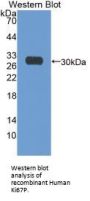Ki-67 Protein (Ki67P) Antibody