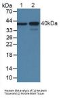 Myelin Basic Protein (MBP) Antibody
