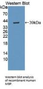 Myelin Basic Protein (MBP) Antibody