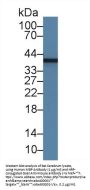 Myelin Basic Protein (MBP) Antibody