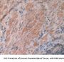 Interleukin 12A (IL12A) Antibody