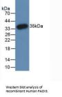 Peptidyl Arginine Deiminase Type III (PADI3) Antibody
