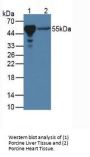Peroxisome Proliferator Activated Receptor Gamma (PPARg) Antibody