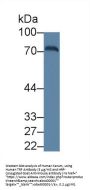 Transferrin (TF) Antibody