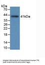 Tryptase (TPS) Antibody