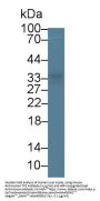 Tryptase (TPS) Antibody