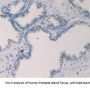 Tryptase (TPS) Antibody