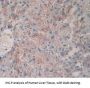 Tryptase (TPS) Antibody