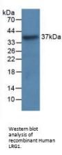 Leucine Rich Alpha-2-Glycoprotein 1 (LRG1) Antibody