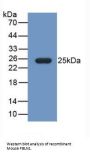 Fibulin 1 (FBLN1) Antibody
