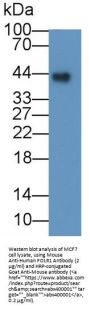 Folate Receptor Alpha (FOLR1) Antibody