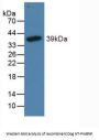 N-Terminal Pro-Brain Natriuretic Peptide (NT-ProBNP) Antibody