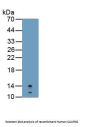 Calprotectin Antibody