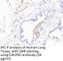Calprotectin Antibody