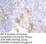 Calprotectin Antibody