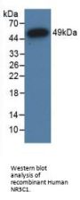 Glucocorticoid Receptor (NR3C1) Antibody