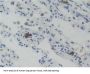 Glucocorticoid Receptor (NR3C1) Antibody