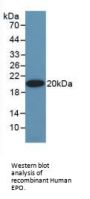Erythropoietin (EPO) Antibody