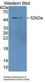 Lamin A/C (LMNA) Antibody