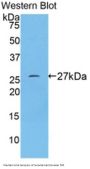 Transferrin Receptor Protein 1 / CD71 (TFRC) Antibody