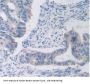 Transferrin Receptor Protein 1 / CD71 (TFRC) Antibody
