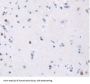 Transferrin Receptor Protein 1 / CD71 (TFRC) Antibody