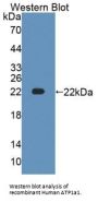 Sodium/Potassium-Transporting ATPase Subunit Alpha 1 (ATP1A1) Antibody