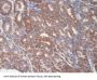 Hepatitis A Virus Cellular Receptor 1 (HAVCR1) Antibody