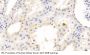 Hepatitis A Virus Cellular Receptor 1 (HAVCR1) Antibody