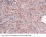 Hepatitis A Virus Cellular Receptor 1 (HAVCR1) Antibody