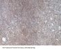 Hepatitis A Virus Cellular Receptor 1 (HAVCR1) Antibody